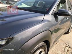 هيونداي كونا